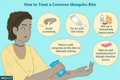 How to Soothe Itchy Mosquito Bites .